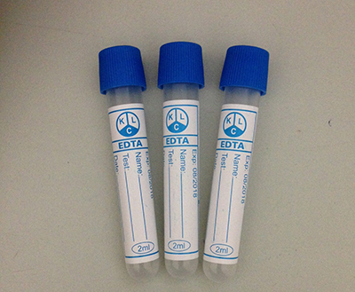 Ống chống đông máu